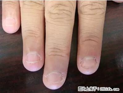 剪指甲、挖耳屎，这些日常小动作竟隐藏大危害！ - 自贡生活资讯 - 自贡28生活网 zg.28life.net